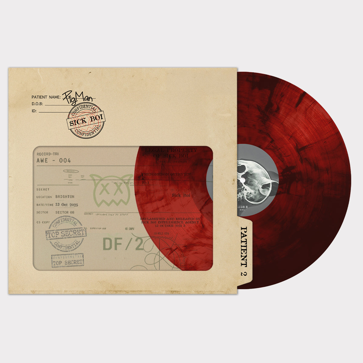 Side view of the Sick Boi Deluxe Vinyl by Ren, a special edition album with vibrant cover art and detailed design.